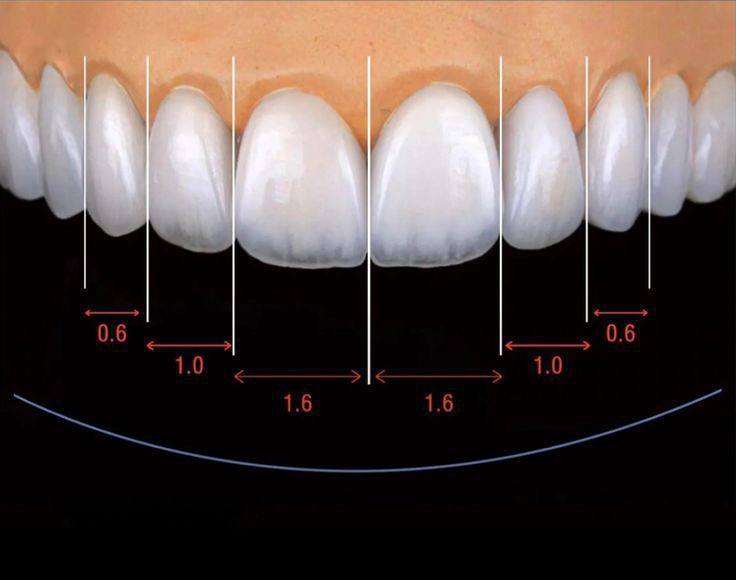 Osteolysis of the jaw2