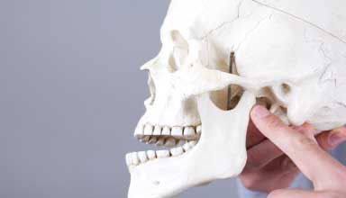 Osteolysis of the jaw3