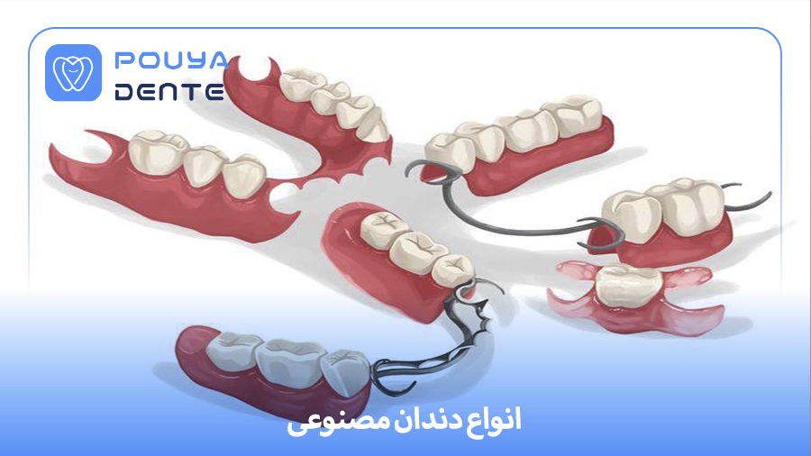 artificial teeth