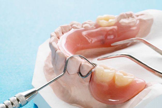 artificial teeth1