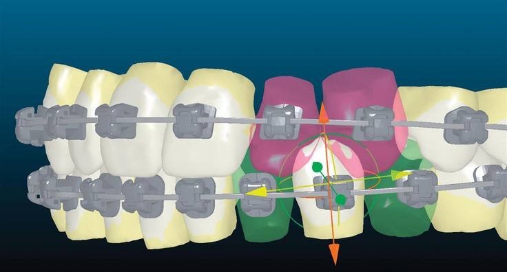 orthodontics5