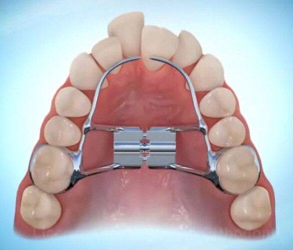 orthodontics1