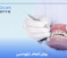 Method of performing orthodontics