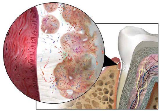 Oral bacteria2