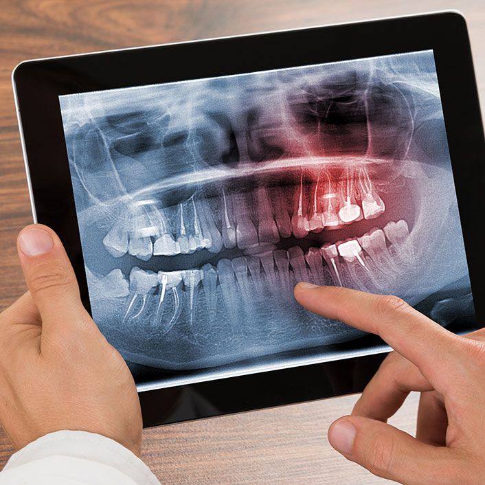 Dental radiography4