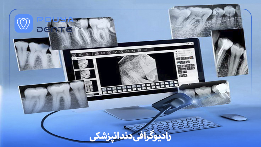 Dental radiography