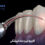 Dental laser