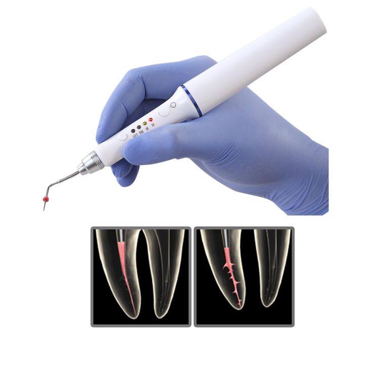 Root canal treatment