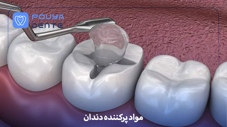 Dental filling materials