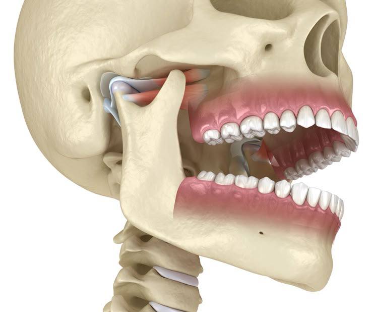 Periodontal surgery