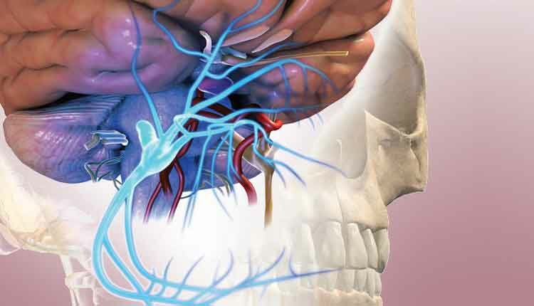 Trigeminal nerve and implants