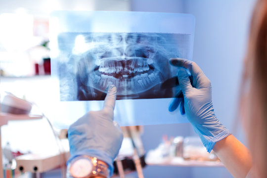 Dental photo interpretation