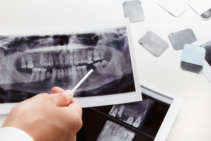 Dental photo interpretation