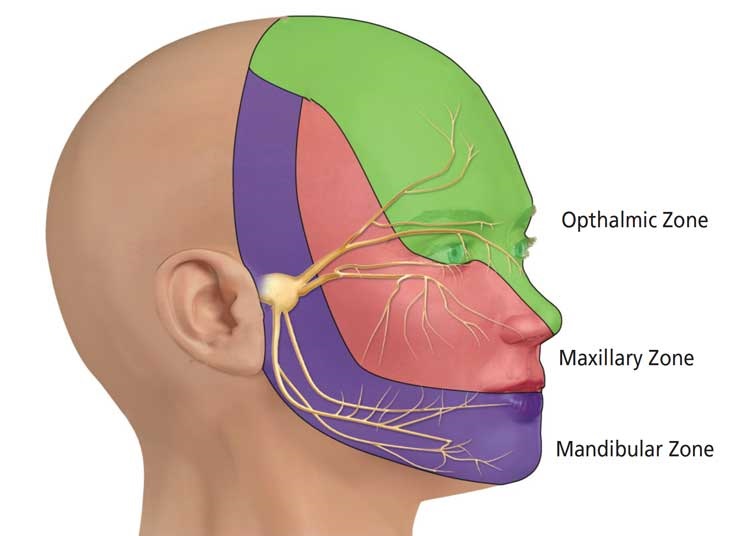 Trigeminal nerve and implants