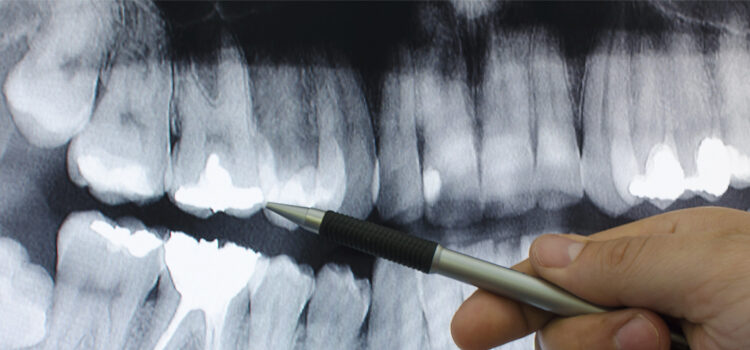 Dental photo interpretation