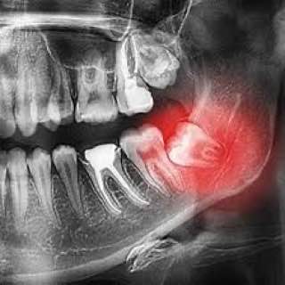 Dental and jaw radiology