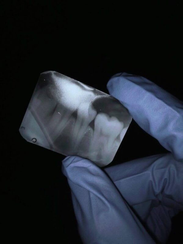 Dental and jaw radiology