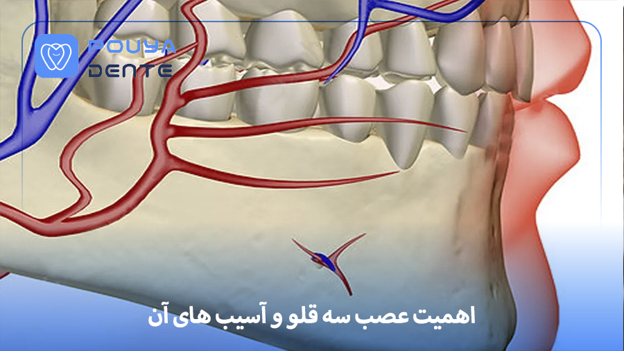Trigeminal nerve and implants