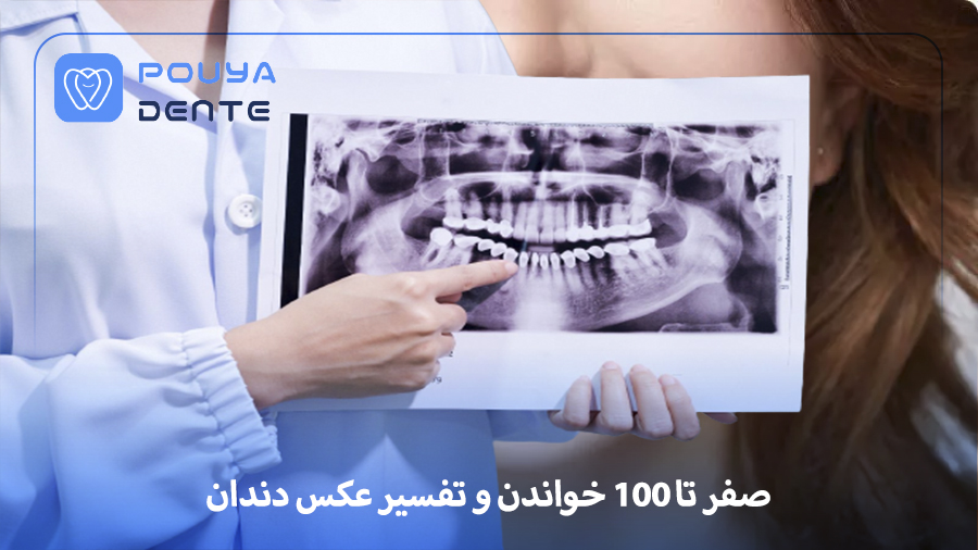 Dental photo interpretation