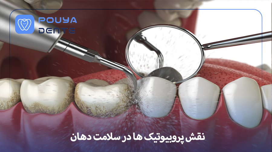Probiotics in oral health
