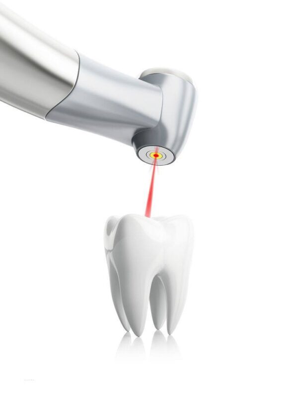 Dental scaling