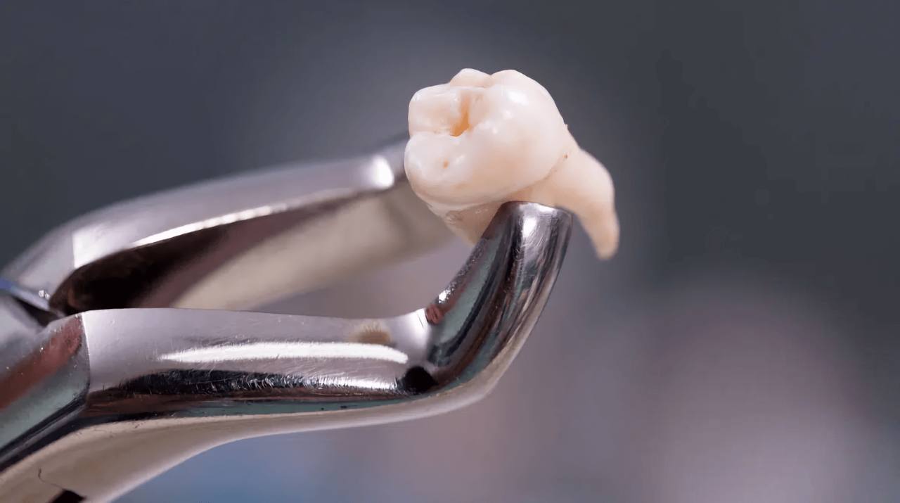 Dental forceps