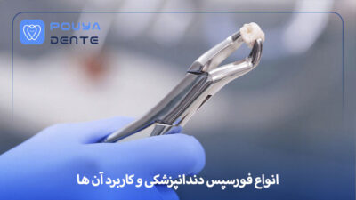 Dental forceps