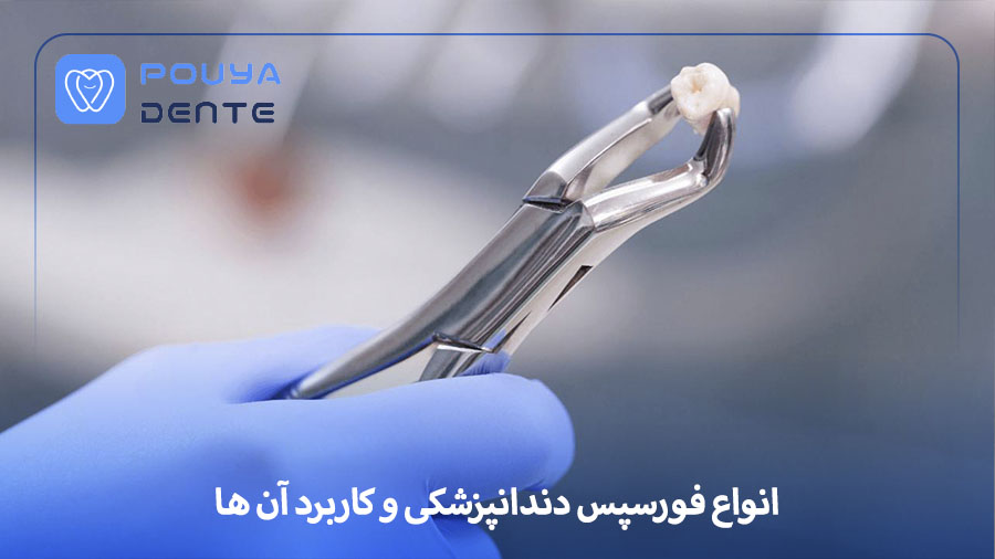 Dental forceps
