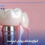 implant-veneer