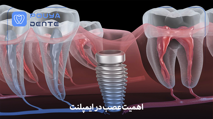 importance of the nerve in implants