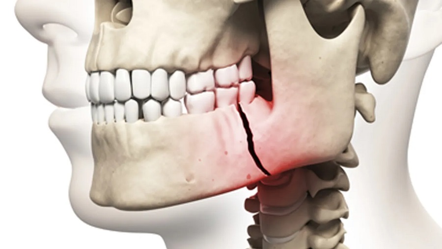 importance of the nerve in implants