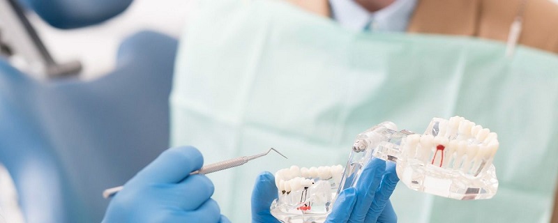 dental post vs implant