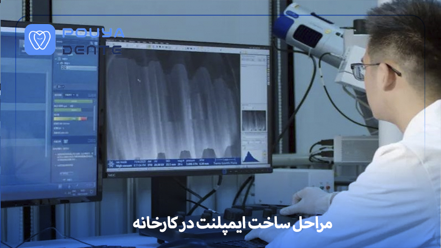 Implant production