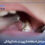 Dental pin