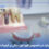 Implant-supported overdenture