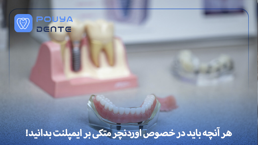 Implant-supported overdenture