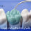 dental-wax-up