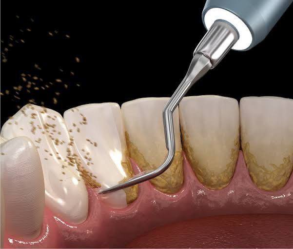 Follow-up after implants
