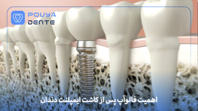 Follow-up after implants