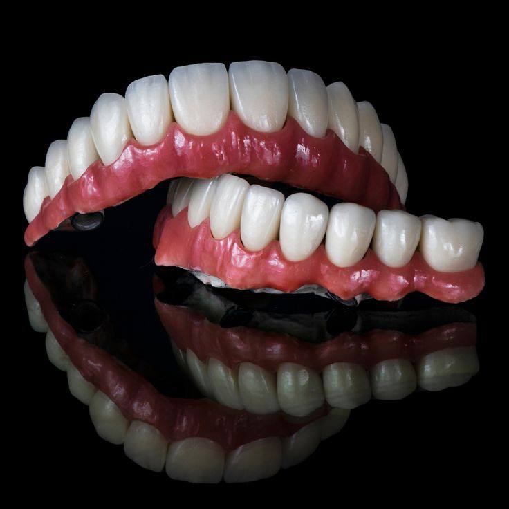 Full implant treatment