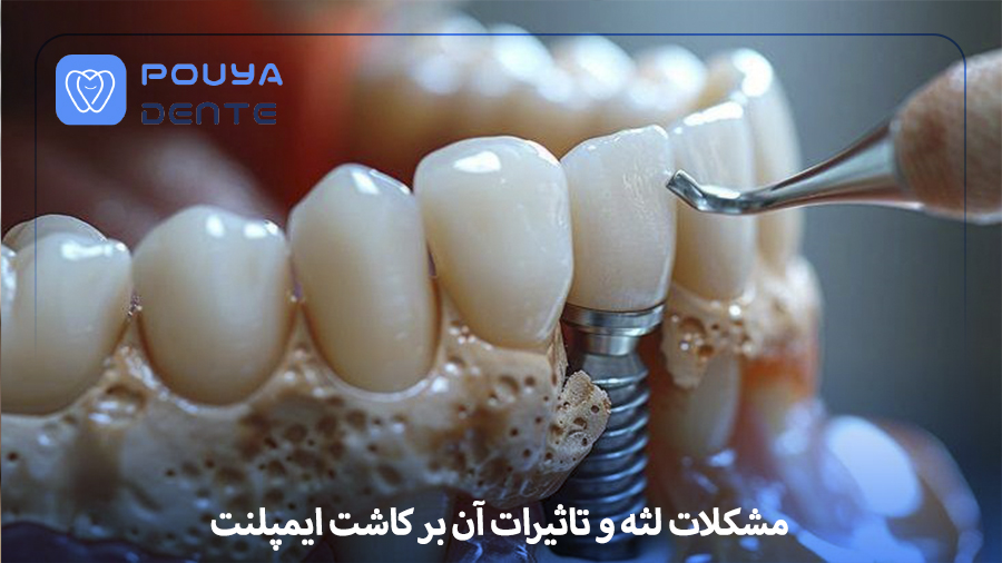 Gum problems in implants