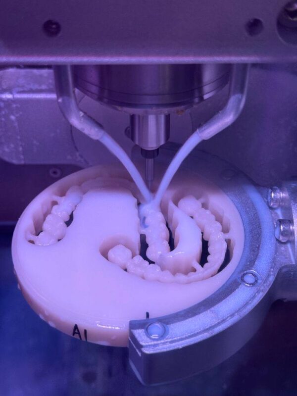 3d-printer-in-dentistry