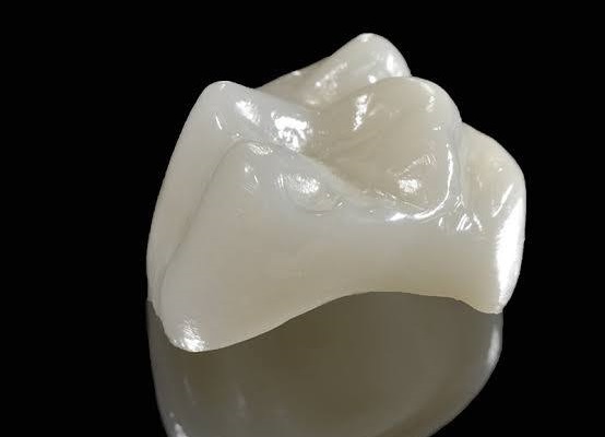molar-tooth-crown