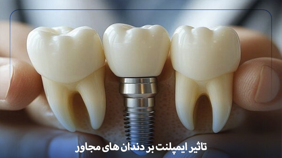 implant effects on near tooth
