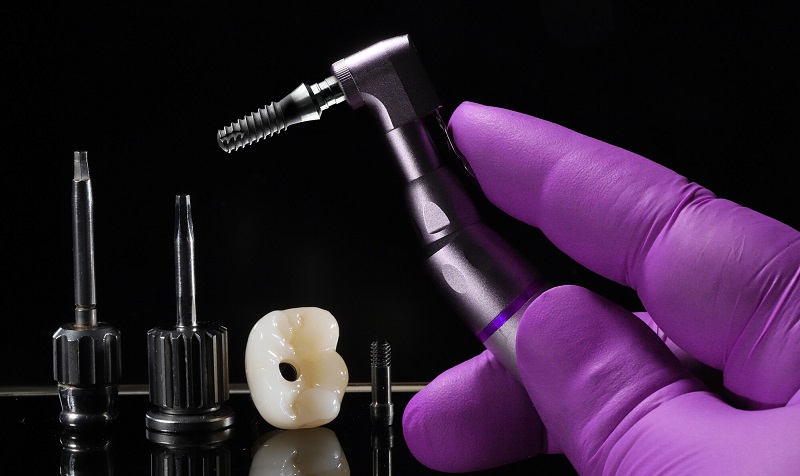 implant-terminology