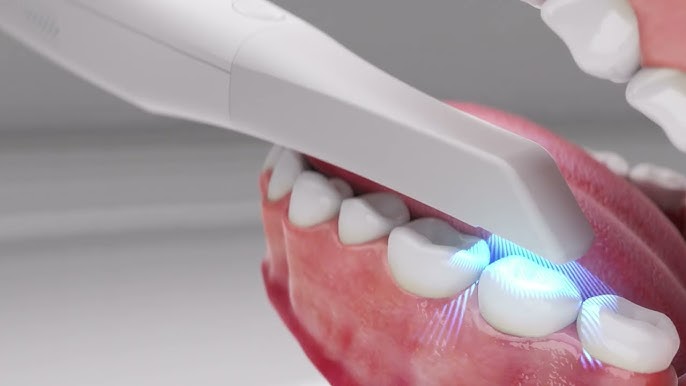 Polywave Light Cure