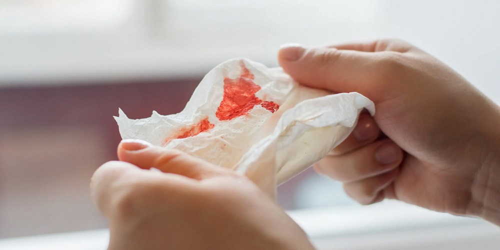Bleeding after implant