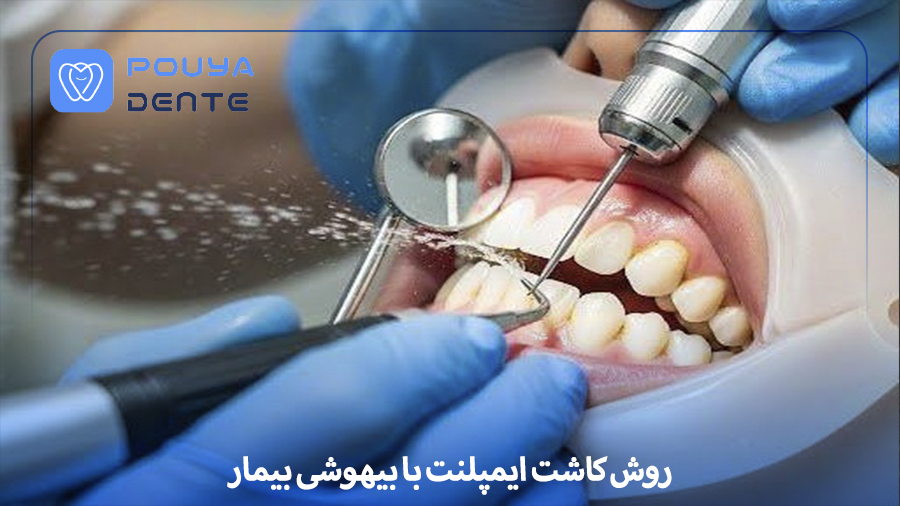 Implant placement with anesthesia