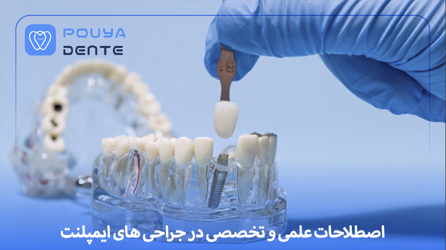 implant-terminology