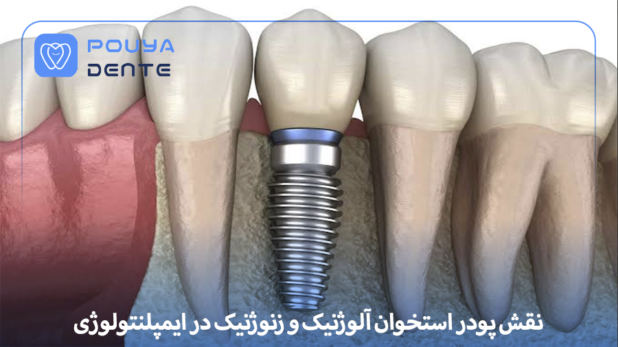 Allogeneic in implantology
